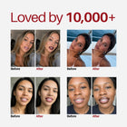 Original customer lip before-and-after comparison